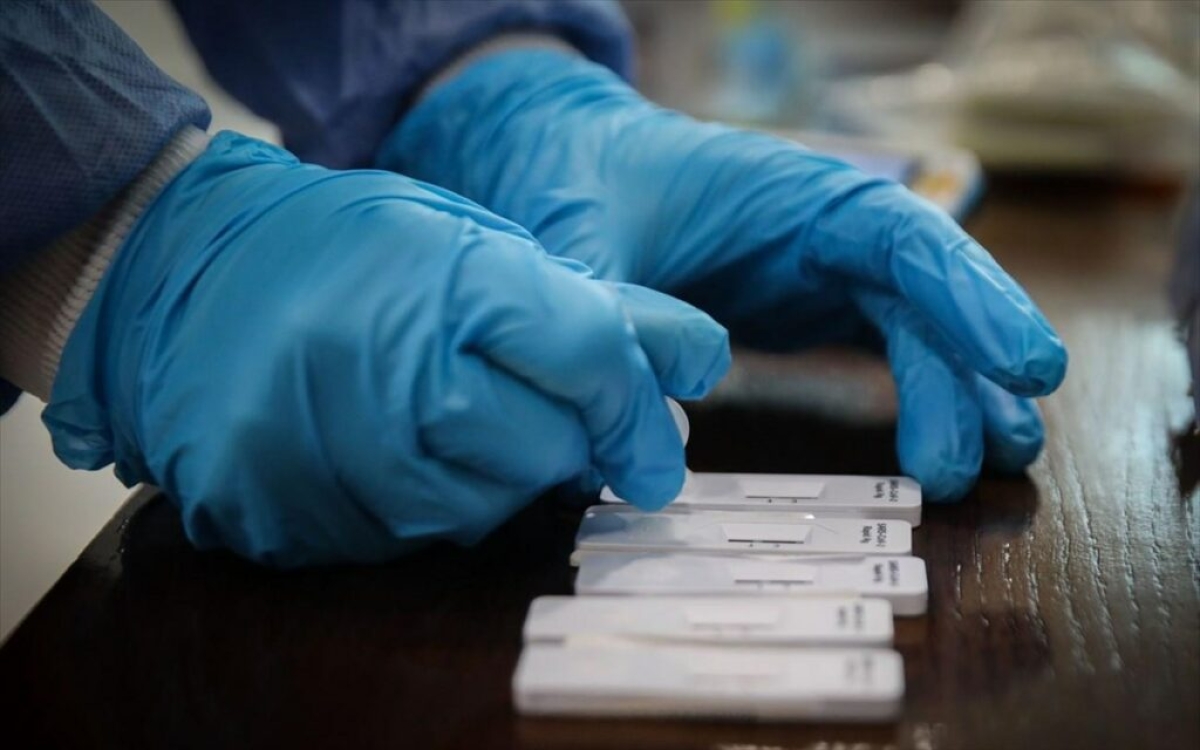 Αιτωλοακαρνανία: Που θα πραγματοποιηθούν την Τετάρτη 18/1/2023 δωρεάν rapid test